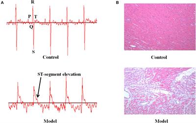 Cecal Gut Microbiota and Metabolites Might Contribute to the Severity of Acute Myocardial Ischemia by Impacting the Intestinal Permeability, Oxidative Stress, and Energy Metabolism